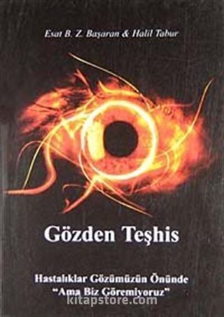 Gözden Teşhis