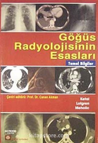 Göğüs Radyolojisinin Esasları