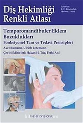 Temporomandibuler Eklem Bozuklukları