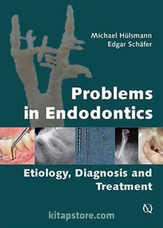 Endodontide Problemler: Etiyoloji, Tanı ve Tedavi