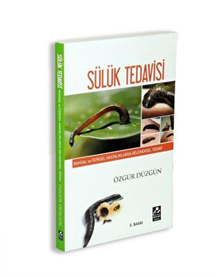 Sülük Tedavisi