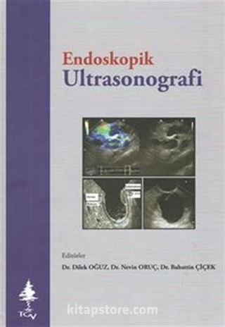 Endoskopik Ultrasonografi