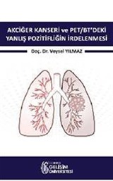 Akciğer Kanseri ve PET/BT'deki Yanlış Pozitifliğin İrdelenmesi