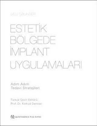 Estetik Bölgede İmplant Uygulamaları