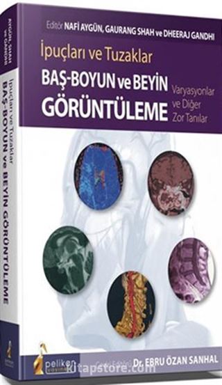 İpuçları ve Tuzaklar Baş - Boyun ve Beyin Görüntüleme Varyasyonlar ve Diğer Zor Tanılar