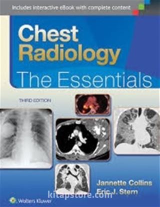 Chest Radiology