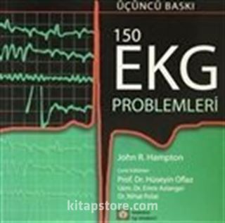 150 EKG Problemleri