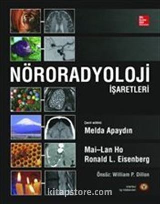 Nöroradyoloji İşaretleri