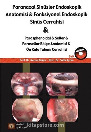 Paranazal Sinüsler Endoskopi Anatomisi ve Fonksiyonel Endoskopik Sinüs Cerrahisi (Dvd'li)