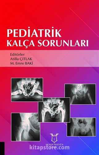 Pediatrik Kalça Sorunları