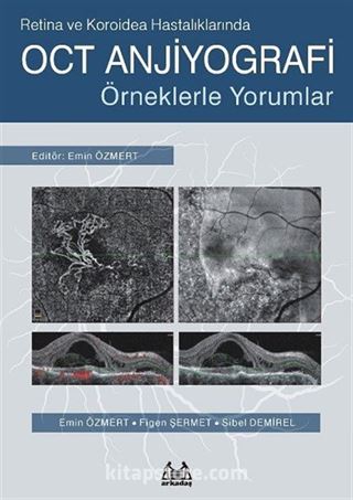 Retina ve Koroidea Hastalıklarında OCT Anjiyografi