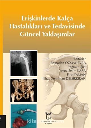 Erişkinlerde Kalça Hastalıkları ve Tedavisinde Güncel Yaklaşımlar