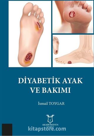 Diyabetik Ayak ve Bakımı