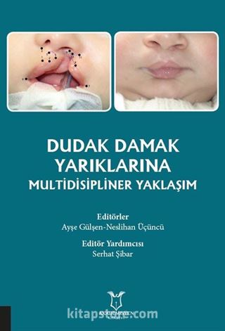 Dudak Damak Yarıklarına Multidisipliner Yaklaşım