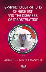 Graphic Illustrations Of Abortion And The Diseases Of Menstruation