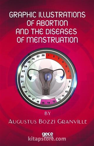 Graphic Illustrations Of Abortion And The Diseases Of Menstruation