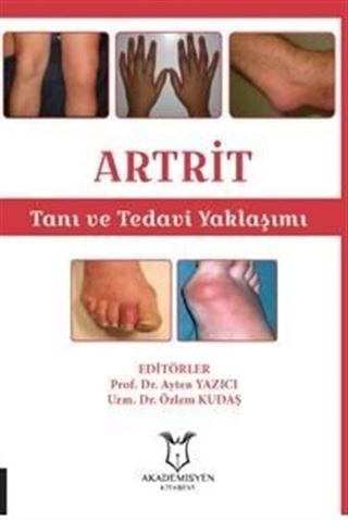 ARTRİT Tanı ve Tedavi Yaklaşımı