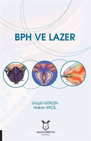 BPH ve Lazer