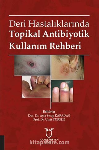 Deri Hastalıklarında Topikal Antibiyotik Kullanım Rehberi