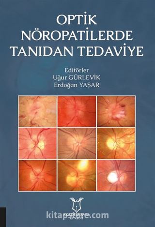 Optik Nöropatilerde Tanıdan Tedaviye