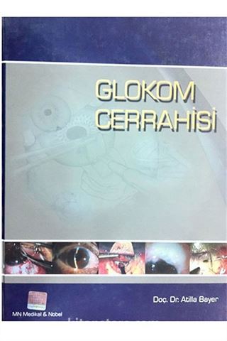 Glokom Cerrahisi