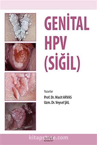 Genital HPV (SİĞİL)