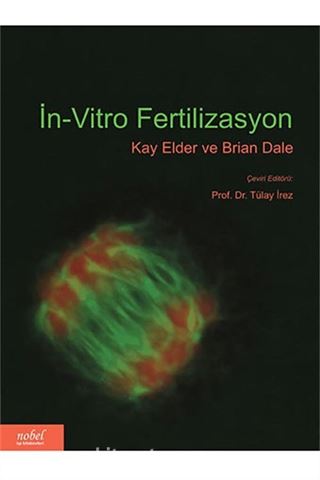 İn-Vitro Fertilizasyon