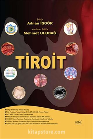 Tiroit