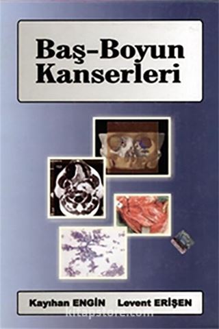 Baş-Boyun Kanserleri