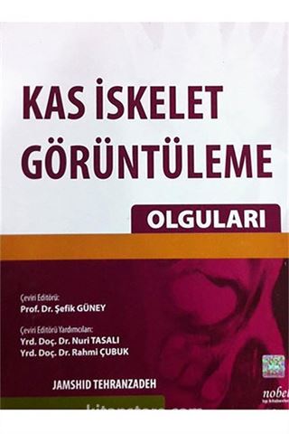 Kas İskelet Görüntüleme Olguları