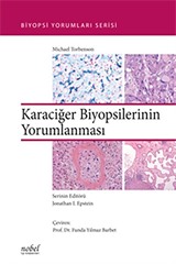 Karaciğer Biyopsilerinin Yorumlanması - Biyopsi Yorumları Serisi