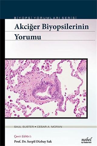 Akciğer Biyopsilerinin Yorumu - Biyopsi Yorumları Serisi