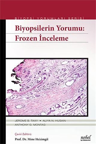 Biyopsilerin Yorumu: Frozen İnceleme - Biyopsi Yorumları Serisi