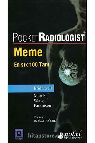 Pocket Radiologist: Meme - En Sık 100 Tanı