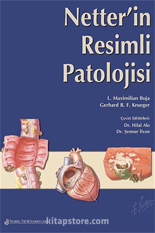 Netter'in Resimli Patolojisi