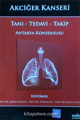 Akciğer Kanseri: Tanı - Tedavi - Takip - Antakya Konsensusu