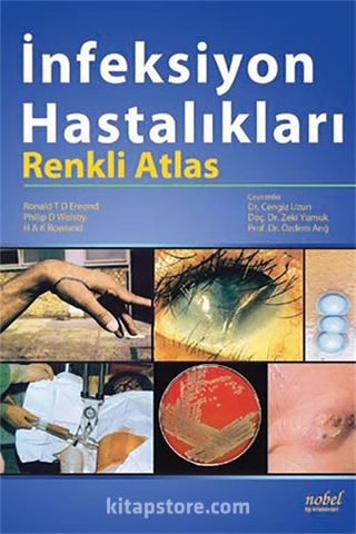 İnfeksiyon Hastalıkları: Renkli Atlas