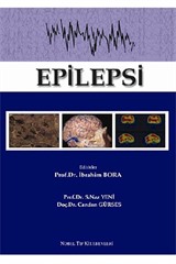 Epilepsi