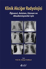 Klinik Akciğer Radyolojisi: Öğrenci, Asistan, Uzman ve Akademisyenler için