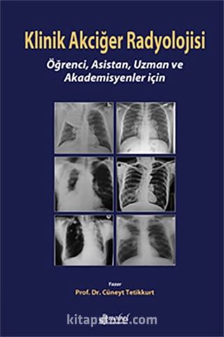 Klinik Akciğer Radyolojisi: Öğrenci, Asistan, Uzman ve Akademisyenler için