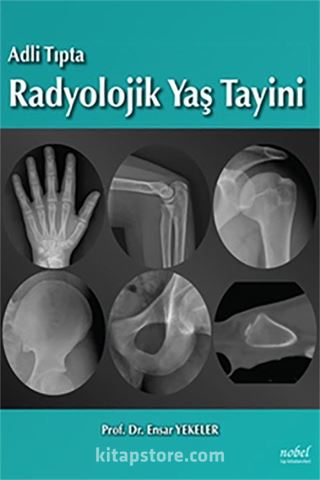 Adli Tıpta Radyolojik Yaş Tayini