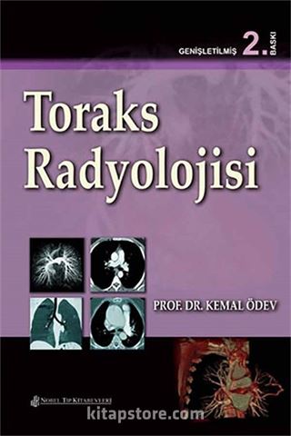 Toraks Radyolojisi