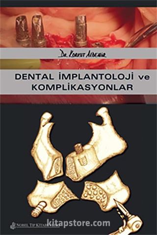 Dental İmplantoloji ve Komplikasyonlar