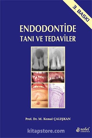 Endodontide Tanı ve Tedaviler