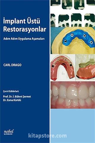 İmplant Üstü Restorasyonlar: Adım Adım Uygulama Aşamaları