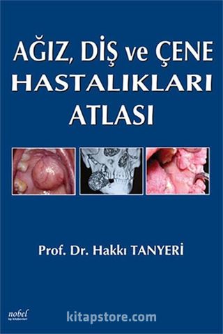 Ağız, Diş ve Çene Hastalıkları Atlası