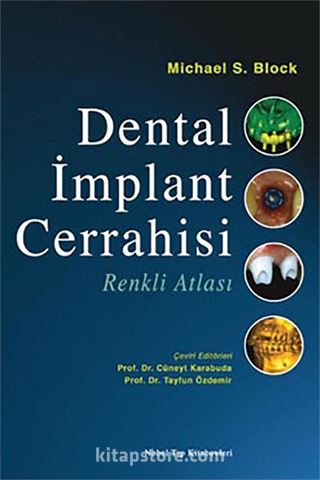 Dental İmplant Cerrahisi Renkli Atlası