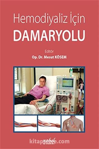 Hemodiyaliz İçin Damaryolu