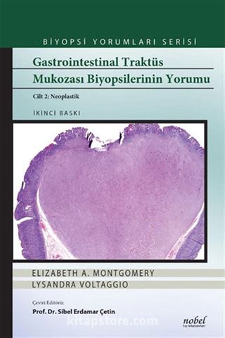 Gastrointestinal Traktüs Mukozası Biyopsilerinin Yorumu Cilt 2: Neoplastik - Biyopsi Yorumları Serisi