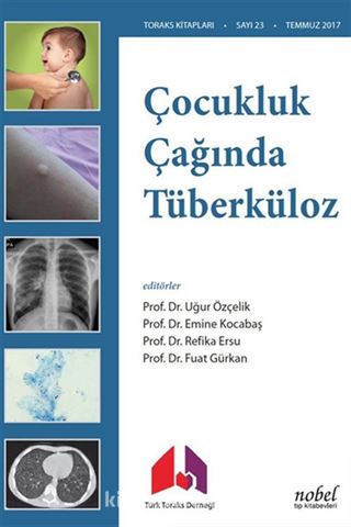 Çocukluk Çağında Tüberküloz Tanı: Tedavi ve Korumada Güncel Yaklaşımlar ve Olgu Örnekleri